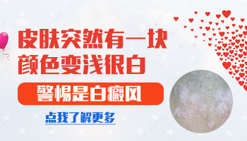 宝宝屁股有白斑